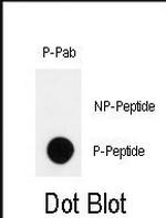 Phospho-HIPK2 (Tyr361) Polyclonal Antibody
