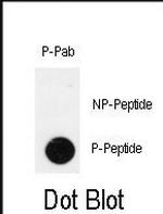 Phospho-PDX1 (Thr11) Polyclonal Antibody