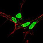 Phospho-Nanog (Ser71) Antibody in Immunocytochemistry (ICC/IF)