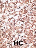 BSEP Polyclonal Antibody