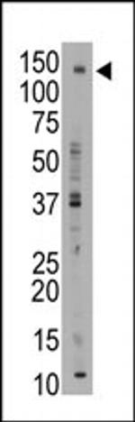 BSEP Antibody in Western Blot (WB)