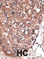 HAND2 Antibody in Immunohistochemistry (Paraffin) (IHC (P))