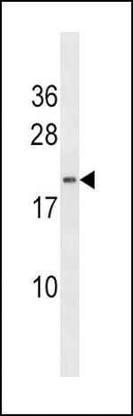 HAND2 Antibody in Western Blot (WB)