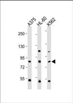ABCB5 Antibody in Western Blot (WB)