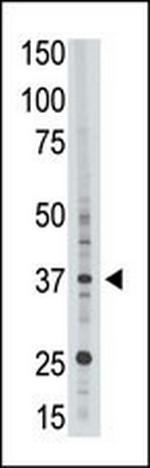 EPR1 Antibody in Western Blot (WB)