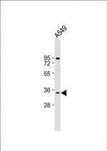 MAGEA2 Polyclonal Antibody