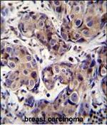 MAGEA3 Polyclonal Antibody