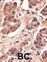 MAGEH1 Polyclonal Antibody