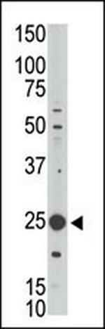 MAGEH1 Antibody in Western Blot (WB)