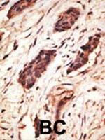 MMP10 Antibody in Immunohistochemistry (Paraffin) (IHC (P))