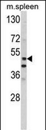 MMP10 Antibody in Western Blot (WB)