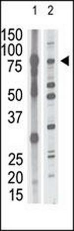MMP15 Antibody in Western Blot (WB)