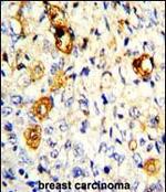 MMP19 Polyclonal Antibody