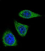 MMP7 Polyclonal Antibody