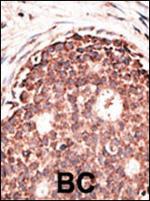 MMP9 Polyclonal Antibody