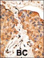 NRG1 Polyclonal Antibody