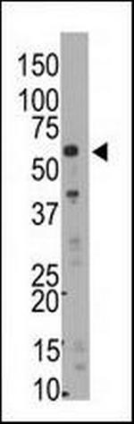 SMYD5 Antibody in Western Blot (WB)