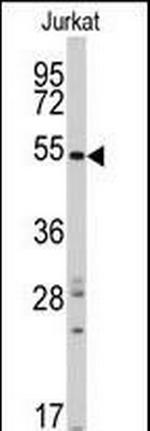 SMYD5 Antibody in Western Blot (WB)