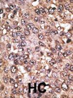 SIRT5 Polyclonal Antibody