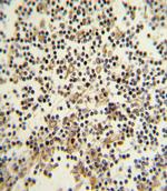 CD82 Polyclonal Antibody