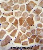 WISP2 Polyclonal Antibody