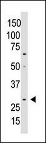 WISP2 Antibody in Western Blot (WB)