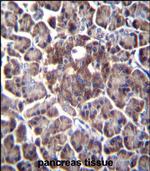DDIT4 Polyclonal Antibody