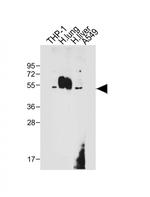 CD14 Antibody in Western Blot (WB)