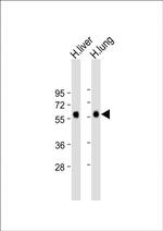 CD14 Antibody in Western Blot (WB)