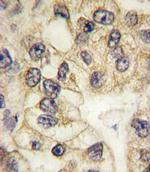 CD14 Antibody in Immunohistochemistry (Paraffin) (IHC (P))