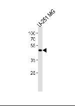 YBX1 Antibody in Western Blot (WB)