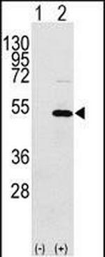 YBX1 Antibody in Western Blot (WB)