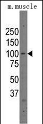 PARP12 Polyclonal Antibody