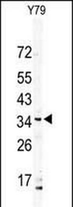 DSCR3 Polyclonal Antibody