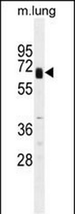 Glypican 3 Polyclonal Antibody