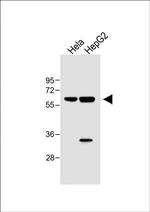 IL1R1 Polyclonal Antibody
