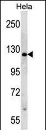 PARP1 Antibody in Western Blot (WB)