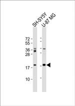 alpha Synuclein Antibody in Western Blot (WB)