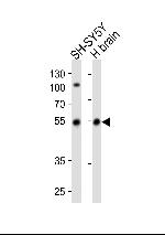 Parkin Polyclonal Antibody