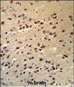 Alsin Polyclonal Antibody