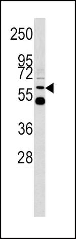 UGT2B17 Antibody in Western Blot (WB)