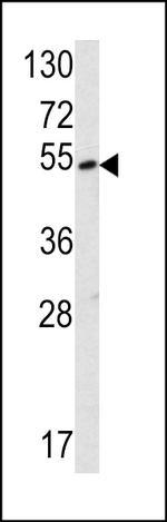 SUV420H2 Polyclonal Antibody