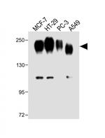 CEA Antibody in Western Blot (WB)