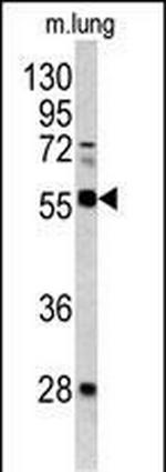 FLI1 Antibody in Western Blot (WB)