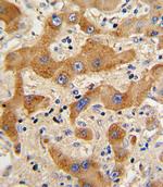 Glucagon Polyclonal Antibody