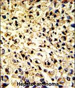 DCL-1 Polyclonal Antibody