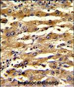 FABP3 Polyclonal Antibody