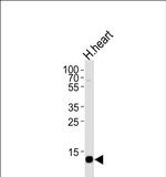 FABP3 Antibody in Western Blot (WB)