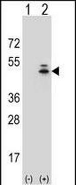 gamma Actin Antibody in Western Blot (WB)