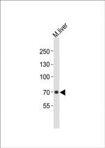 Albumin Antibody in Western Blot (WB)